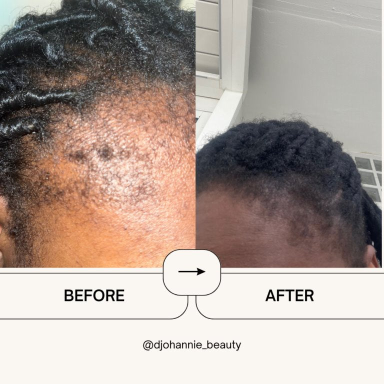 avant et après pour le serum pour cheveux
